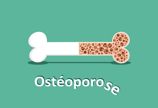 Une chirurgie qui redonne de l’espoir aux patients atteints d'ostéoporose